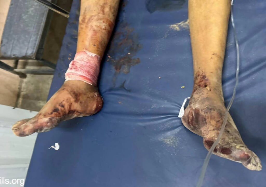 شهيد طفل وإصابات وغارات متواصلة.. وانتهاكات متصاعدة رغم وقف النار 4